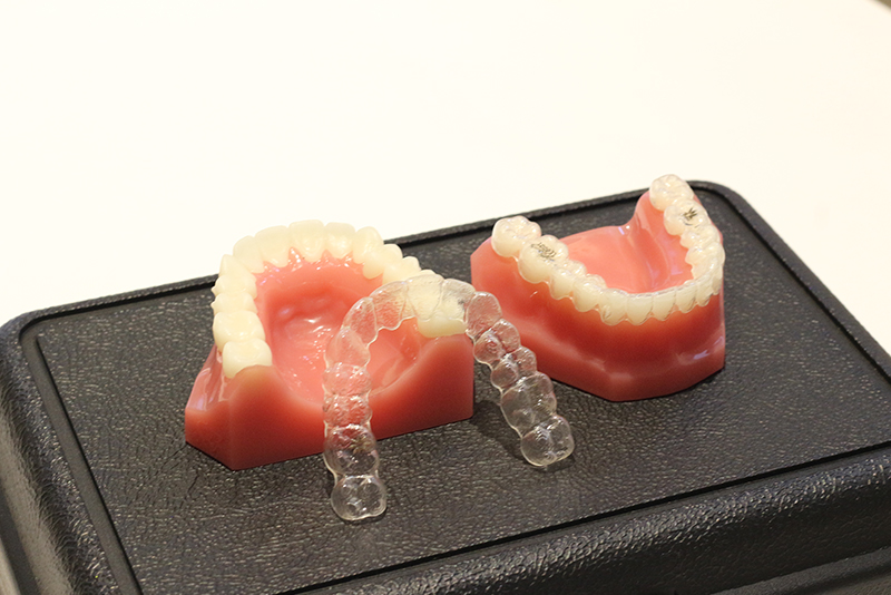 マウスピース型矯正装置（インビザライン）